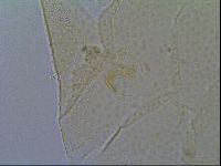 Mopsechiniscus schusteri image