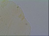Mopsechiniscus schusteri image