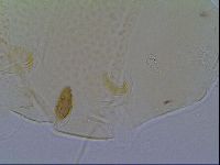 Mopsechiniscus schusteri image
