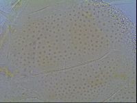 Mopsechiniscus schusteri image