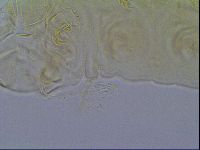 Mopsechiniscus schusteri image