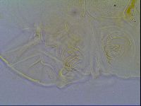 Mopsechiniscus schusteri image