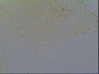 Mopsechiniscus schusteri image