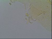 Mopsechiniscus schusteri image