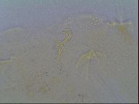 Mopsechiniscus schusteri image