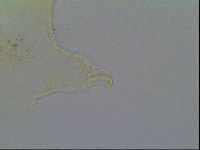 Mopsechiniscus schusteri image