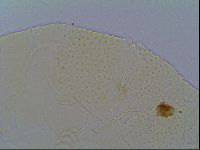 Mopsechiniscus schusteri image
