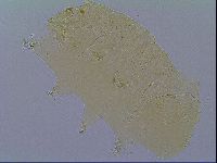 Mopsechiniscus schusteri image
