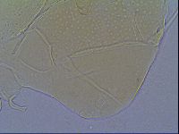 Mopsechiniscus schusteri image