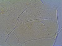 Mopsechiniscus schusteri image