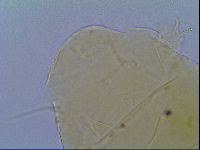 Mopsechiniscus schusteri image