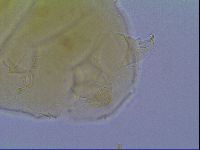 Mopsechiniscus schusteri image