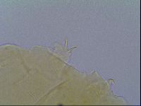 Mopsechiniscus schusteri image