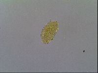 Mopsechiniscus schusteri image