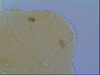 Mopsechiniscus schusteri image