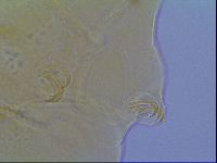 Mopsechiniscus schusteri image
