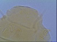 Mopsechiniscus schusteri image