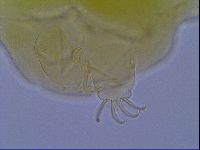 Mopsechiniscus schusteri image