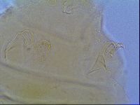 Mopsechiniscus schusteri image