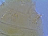 Mopsechiniscus schusteri image