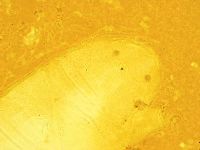 Echiniscus calcaratus image