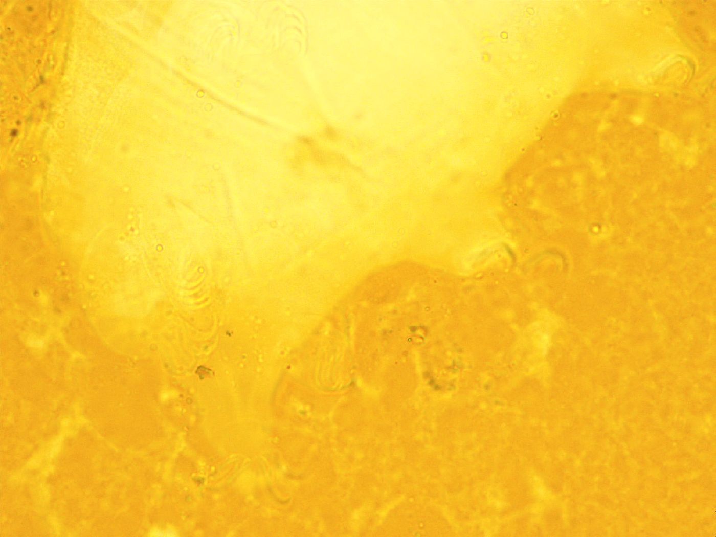 Echiniscus calcaratus image