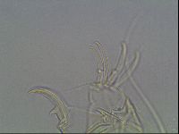 Testechiniscus laterculus image