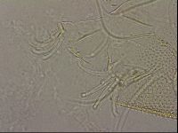 Testechiniscus laterculus image