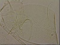 Testechiniscus laterculus image