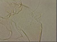 Testechiniscus laterculus image