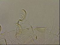 Testechiniscus laterculus image