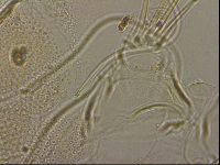 Testechiniscus laterculus image