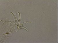 Testechiniscus laterculus image