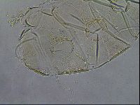 Testechiniscus laterculus image
