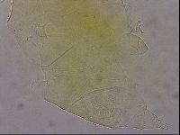 Echiniscus wendti image