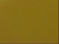 Echiniscus quadrispinosus image