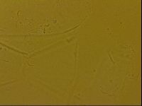 Echiniscus quadrispinosus image