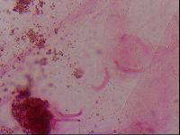 Haplomacrobiotus hermosillensis image