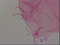 Haplomacrobiotus hermosillensis image