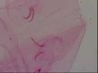 Haplomacrobiotus hermosillensis image