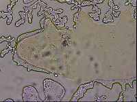 Ramazzottius oberhaeuseri image