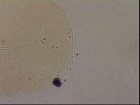 Ramazzottius oberhaeuseri image