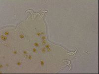 Ramazzottius oberhaeuseri image