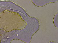 Ramazzottius oberhaeuseri image