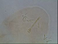 Ramazzottius oberhaeuseri image