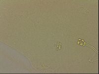 Ramazzottius oberhaeuseri image