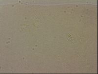 Ramazzottius oberhaeuseri image