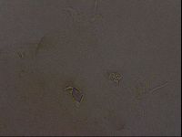 Ramazzottius oberhaeuseri image