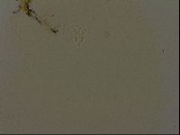 Media resource of Pilatobius oculatus