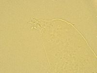 Pilatobius oculatus alpinus image